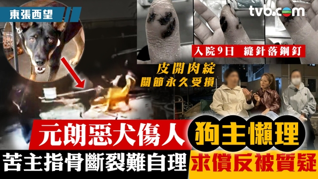 東張西望｜元朗惡犬傷人狗主懶理 苦主指斷骨難自理求償反被質疑 入院9日縫針落鋼釘