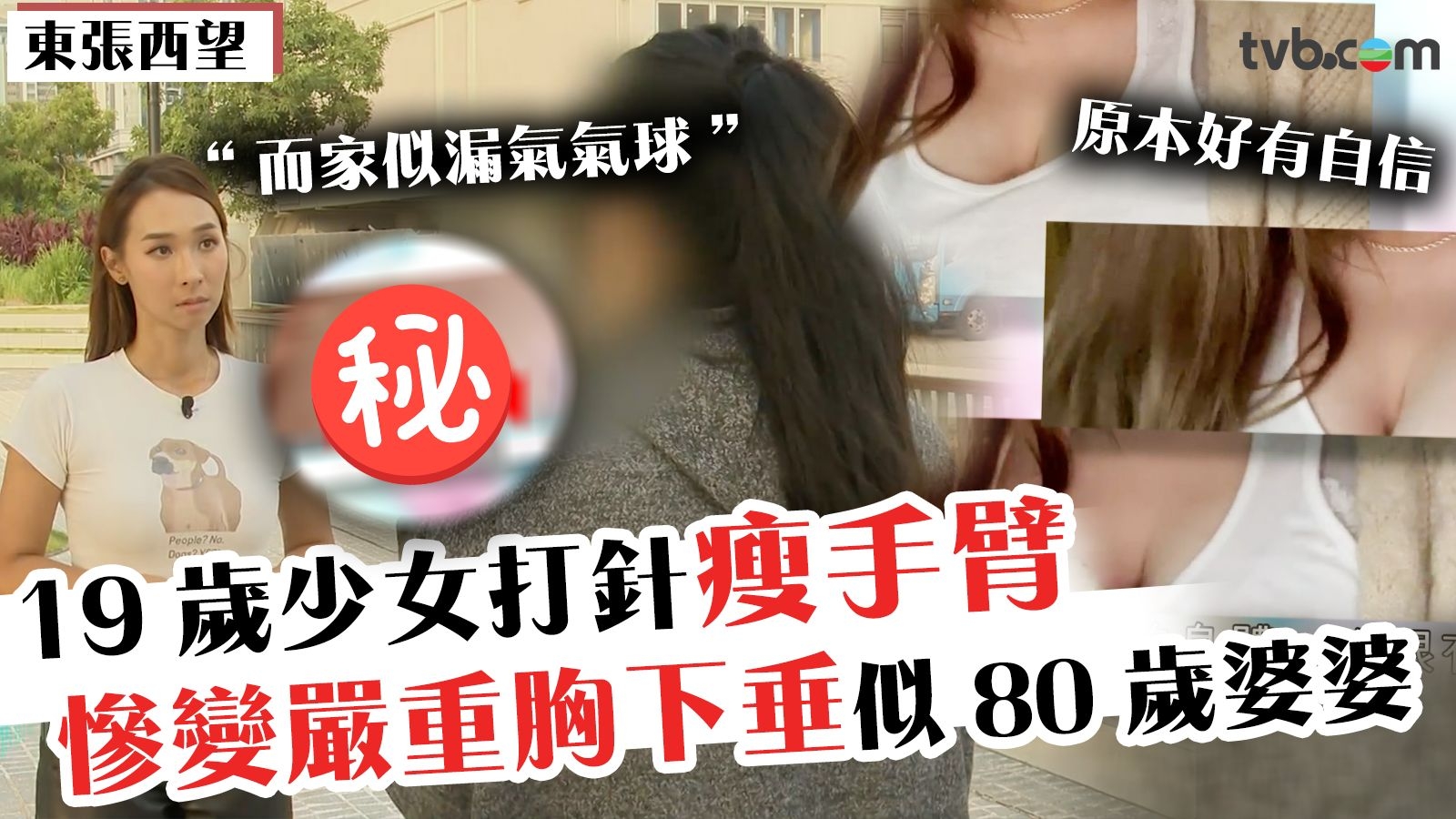 東張西望｜19歲少女打針瘦手臂 慘變嚴重胸下垂似80歲婆婆 劇痛難忍且無法修復：我連死都諗過