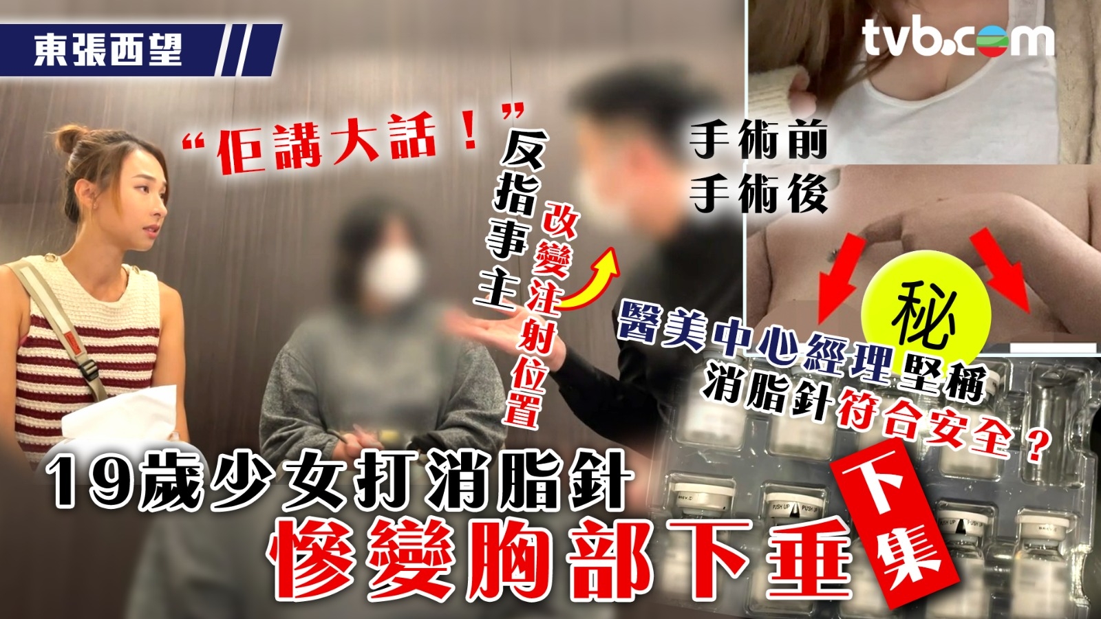 東張西望｜19歲少女打消脂針慘變胸部下垂下集 醫美中心經理反指事主改變注射位置 堅稱消脂針符合安全？