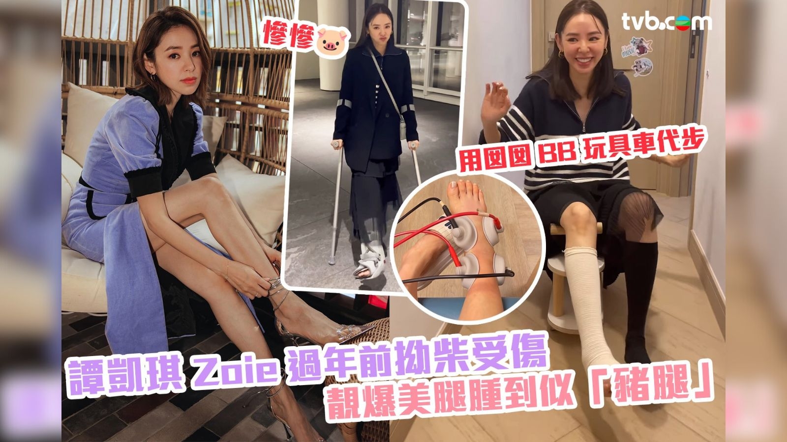 譚凱琪Zoie過年前拗柴 靚爆美腿腫到似「豬腿」😢！樂觀用囡囡BB玩具車代步